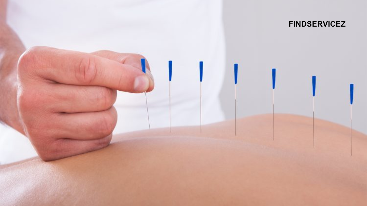 How Acupuncture Can Improve Your Health: A Comprehensive Guide